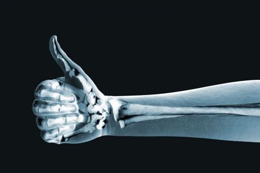 X-rays can be helpful in diagnosing pain in the finger joints