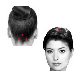 The points on the head of a headache at the back of the head and crown