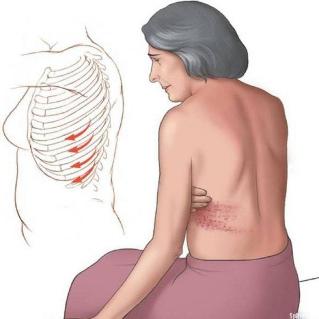 The ribs from the back pain causes