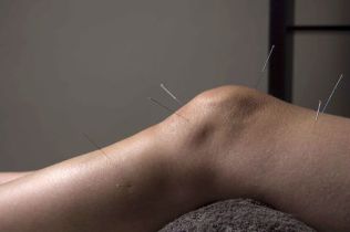 Acupuncture promotes repair of joint tissue